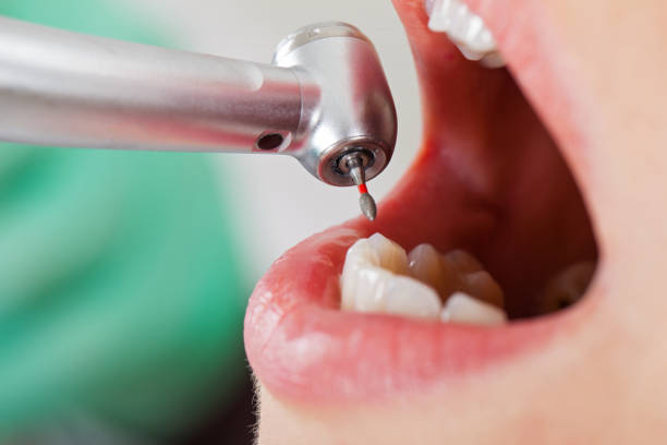 Best Holiday Emergency Dentist in Lake Arrowhead, ME